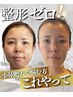 脱！老け顔【瞬間リフトupでVライン小顔】とにかく小顔ハリ艶になりたい人