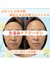 【たった１回でリフトアップ】至福デコルテハンド込＋たるみケア90分¥7480