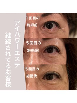 ラフィーユ うるま店(Lafille)/アイパワーエステ