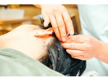 中村温灸院/美容鍼