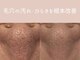 ベアール(beal)の写真/【毛穴悩みに本気の集中ケア】毛穴状態に合わせた２種のハーブピーリング!剥離ありor毛穴洗浄+剥離なし