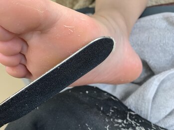 シェリル 田無店(Cherilu)/FOOT角質ケア