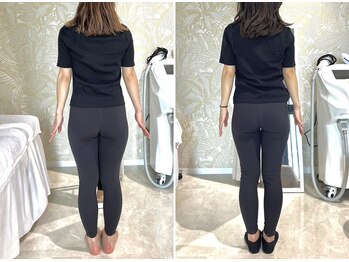 セレーネボーテプラス/