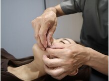 リコンディショニング 自由が丘(Reconditioning)の雰囲気（人気の美容鍼もご用意しております。「美と健康」を求める方に）