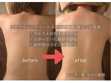 ラジェム(La gemme.)の雰囲気（30代後半/女性モニター様◎1度の施術でむくみが解消！痩せへ☆）