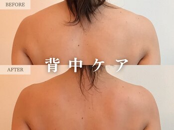 レヴェリー 心斎橋店(REVERIE)/‐ BODYラジオ波 ‐