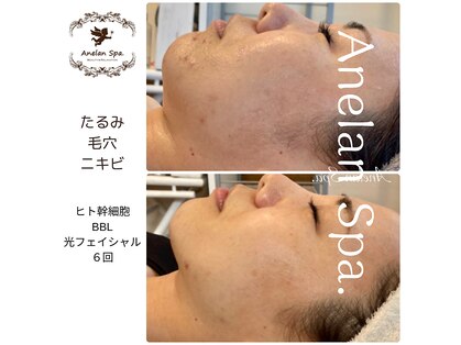 アネランスパ(Anelan Spa.)の写真