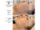 アネランスパ(Anelan Spa.)の写真