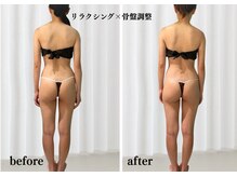 オトサロン(Otosalon)/全身ケア