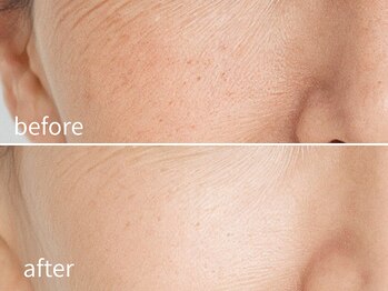 ソレイユ(Soleil)/透明感・ハリ