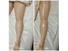 コア(Coeur)の雰囲気（ウルトランスフォーマーでむくみ撃退！痩身ケアに）