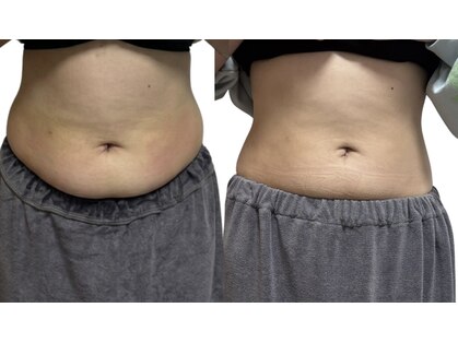 ルナ(LUNA)の写真