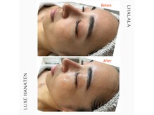 リュクス(Luxe+TKM HANATEN)/ララピール