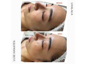 リュクス(Luxe+TKM HANATEN)/ララピール