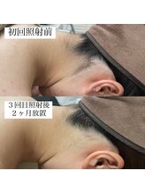 テンパ ビューティー(+10%beauty)/効果写真