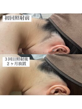 テンパ ビューティー(+10%beauty)/効果写真