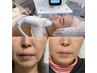 【40代～本気のリフトアップケア】表情筋EMS+美容液導入でふっくらハリ肌！