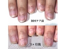 ネイルサロン アミュゼ