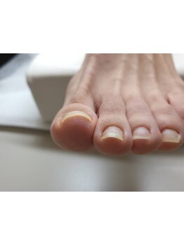 フットネイルがおすすめのサロン