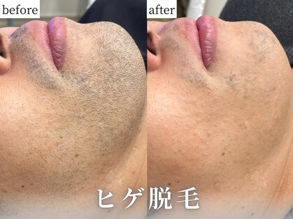 ぺルラ 島田駅前店(Perla)の写真