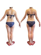 ミースパ(ME SPA)/40代女性/一回の施術