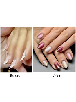 爪の悩みを解消できる（ケア含む）