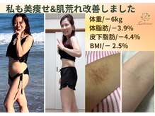 ヨサパーク リボーン(YOSA PARK Reborn)/オーナーがルルオンで激痩せした