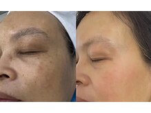 スパ アールアンドビー(SPA*R&B)の雰囲気（くすみ/シミケア/毛穴★小顔×BBL★トータルエイジングケア）