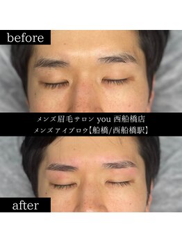 ユー 西船橋店(you)/ビフォーアフター写真