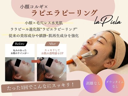 ルル(Ruru)の写真