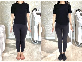 セレーネボーテプラス/