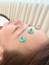 えにし整体 鍼灸整骨院/眼精疲労にはお灸が効果抜群◎