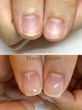 マリーロール 梅田店(Marie Laure)/深爪矯正/自爪育成/自爪風