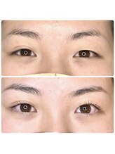 ライミスト(Limist)/まつ毛パーマ