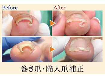 福岡巻き爪補正店 博多店