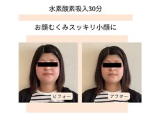 シェノン(CHAINON)の雰囲気（一度で実感★飲み食べ過ぎのむくみ取りも水素酸素吸入にお任せ！）
