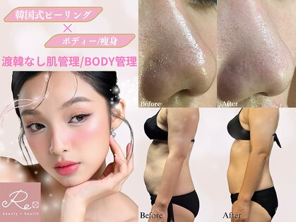 リプラス(Replus)の写真