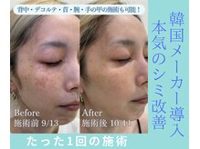 ザ ベッピン(the 別嬪)/韓国発！ベロン動画バズり中