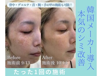 ザ ベッピン(the 別嬪)/韓国発！ベロン動画バズり中