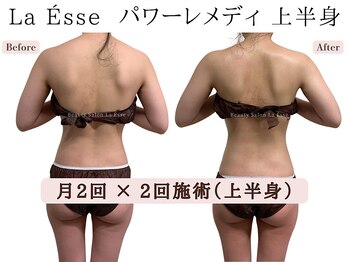ラエッセ(La Esse)/ハマる！極上筋膜リリース