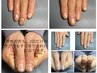 メンズ育成ネイルケア（パック付）