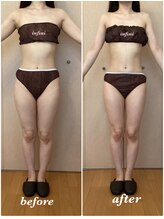 アンフィニ(infini)/短期集中コース7回目（1.5ヶ月）