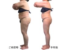 ミテ(Mite)の雰囲気（体脂肪が30%を超え健康的に痩せたい！けど運動は苦手でも大丈夫）