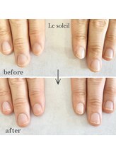 ル ソレイユ(Le soleil)/ネイルケアで美爪に　byあやか