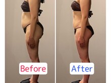 ソルーブ 広尾店/BeforeAfter