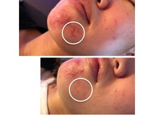 スリリアン 銀座/★お客さまビフォーアフター★