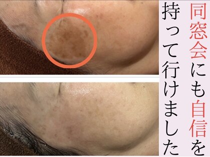 ミニョン(Mignon)の写真