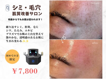 ココビ(COCOVi)の写真