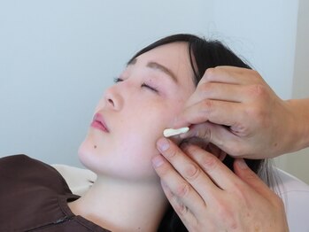 かつらはりきゅう 小児しん/美容ていしんで小顔リフトアップ