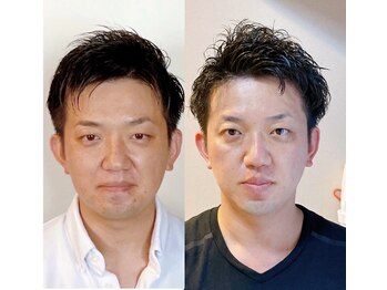 小顔22 ボルティ 本店(Bolty)/Before→After(11回目)輪郭